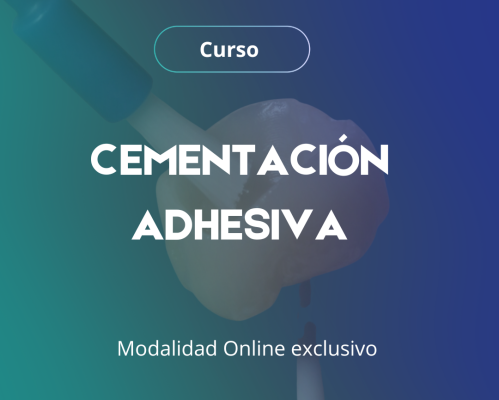 Cementación Adhesiva